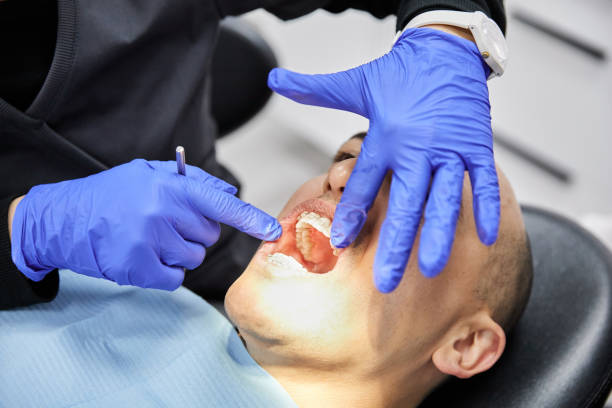 Best Emergency Dental Care for Broken or Chipped Teeth in Milan, OH