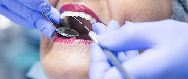Best Emergency Treatment for Dental Infections or Abscesses in Milan, OH